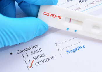معبر رأس الجدير: ضبط 21 تحليل مخبري “PCR” مفتعل