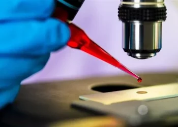 الإيدز: الصدفة تقود إلى علاج محتمل لمرض نقص المناعة المكتسبة