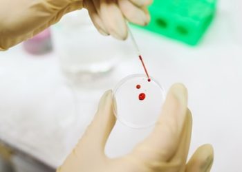 أول تجربة سريرية لنقل دم مصنوع في المختبر للبشر