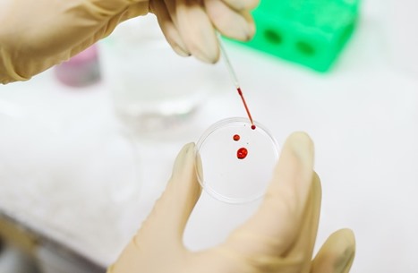 أول تجربة سريرية لنقل دم مصنوع في المختبر للبشر