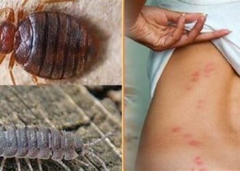 “البق” يغزو باريس.. والحكومة تسابق الزمن للقضاء عليه