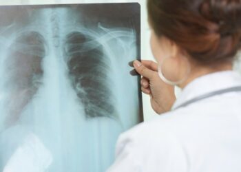 جهات-نابل: 20 مصابا بمرض السلّ