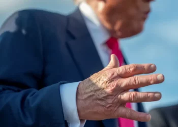 بسبب تورّم في أسفل الساقين وكدمات في اليدين… ترامب يخضع لفحص طبّي