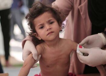 غزة: ظهور أمراض قاتلة معدية بين الاطفال بسبب الحصار الاسرائيلي