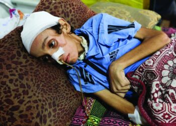 التّجويع يقتل امرأة من غزة بعد نقلها الى مستشفى في إيطاليا