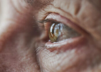 مستشفى الفحص: انتفاع أكثر من 100 شخص بخدمات يوم مفتوح لتقصي اعتلال الشبكية السكري