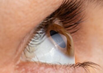 نجاح أوّل عملية زرع قرنية بالمستشفى الجامعي بدر الدين العلوي بالقصرين