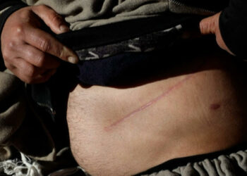 8 سنوات سجنا لفتاة تنشط بين تركيا وتونس لإستقطاب الأشخاص قصد بيع أعضائهم