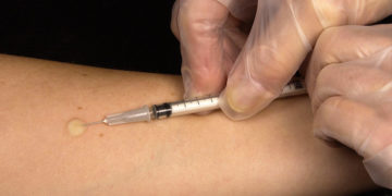 Percée tuniso-indienne vers un nouveau vaccin contre la Tuberculose