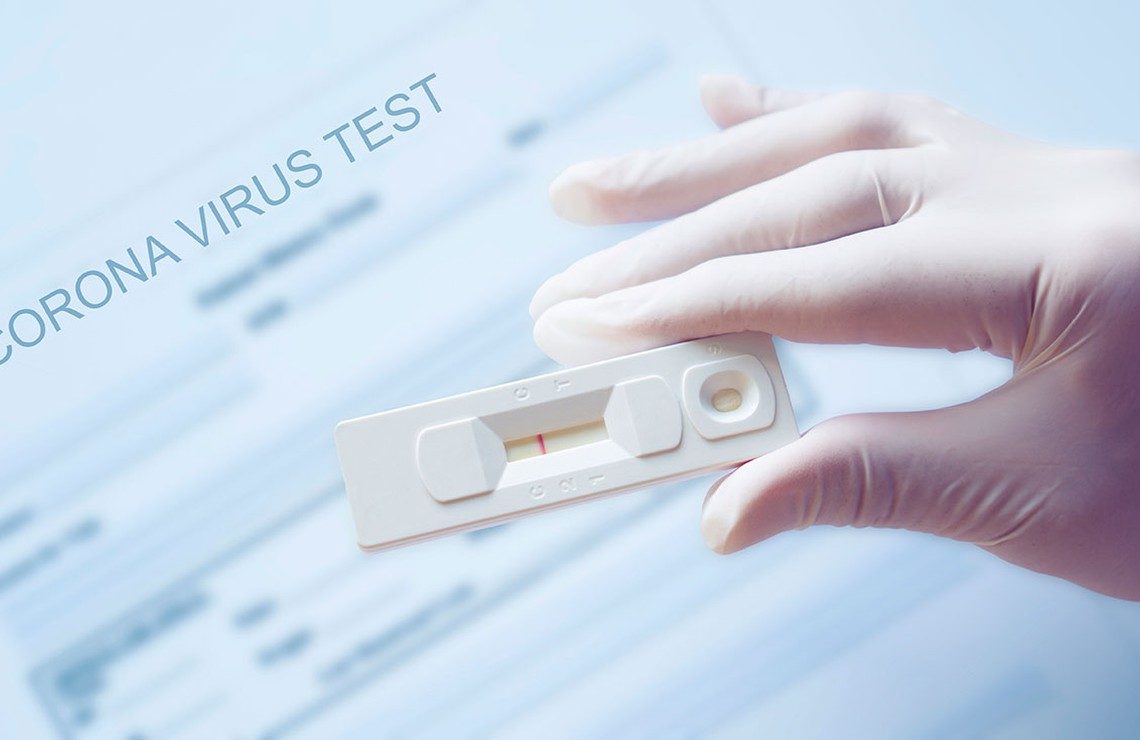 Covid-19: les tests rapides disponibles en pharmacie … Mais …