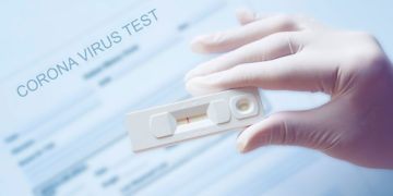 Covid-19: les tests rapides disponibles en pharmacie … Mais …