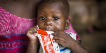 Soudan : 2 millions de personnes de plus risquent de souffrir de malnutrition aiguë, 19 millions au total, selon l’ONU