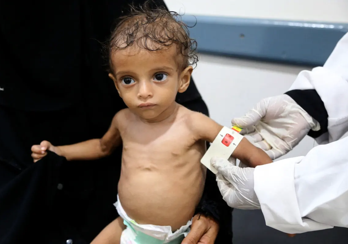 Plus de 330 millions d’enfants en situation d’extrême pauvreté, alerte l’Unicef