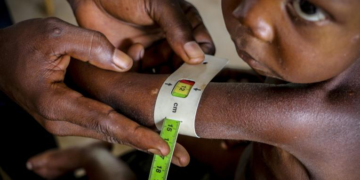 RDC: la malnutrition touche 9,2 millions d&rsquo;enfants et coûte plus d&rsquo;un milliard de dollars par an (UNICEF)