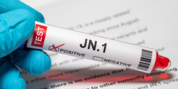 JN.1: Ces symptômes inhabituels peuvent être liés à un nouveau variant du Covid