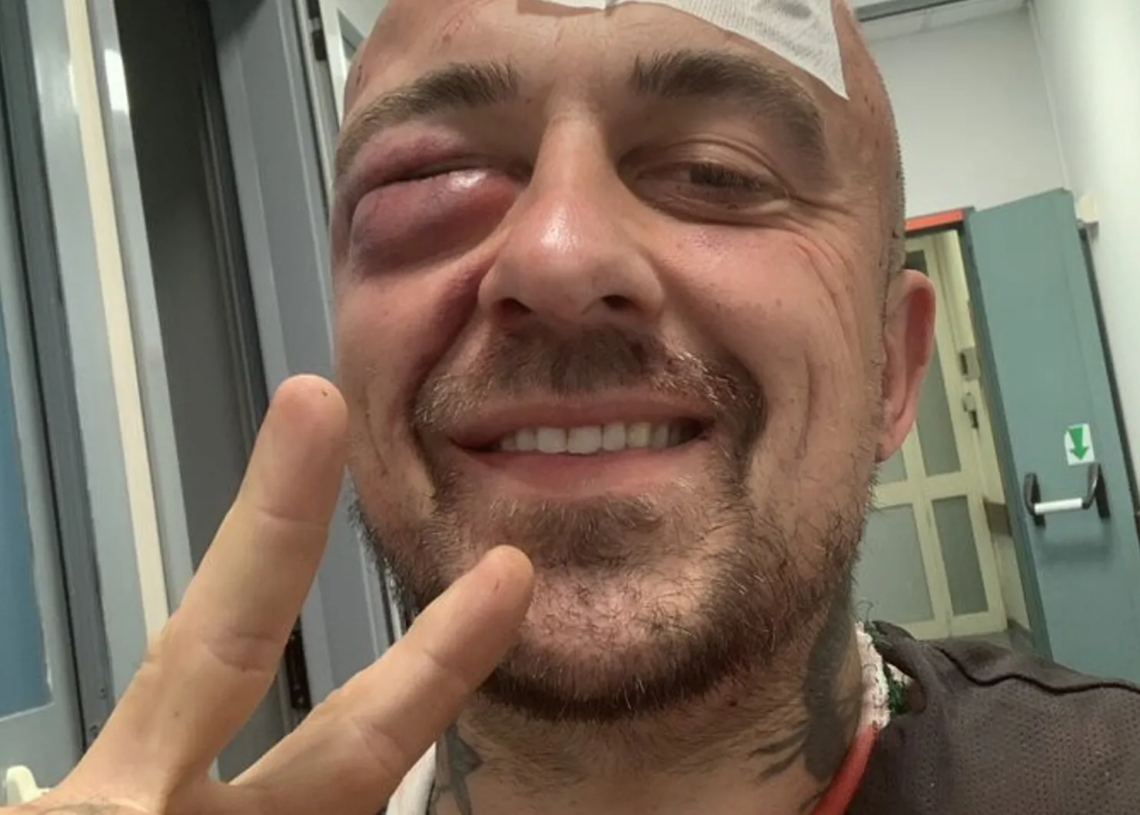 Italie: Défenseur de la cause palestinienne, le Chef Rubio tabassé par « la mafia sioniste »