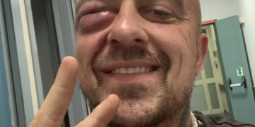 Italie: Défenseur de la cause palestinienne, le Chef Rubio tabassé par « la mafia sioniste »