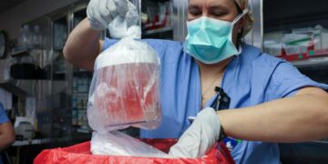 Le premier homme à avoir reçu une greffe de rein de porc génétiquement modifié est mort