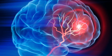 AVC: 3 000 cas enregistrés chaque année en Tunisie