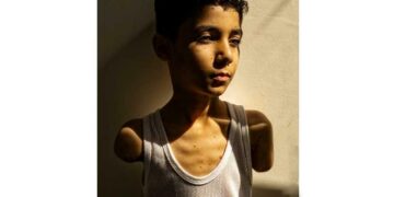 Le portrait d’un enfant palestinien amputé remporte le World Press Photo