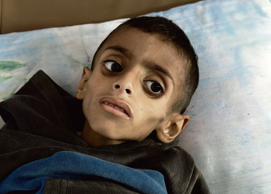 « Des enfants trop faibles pour pleurer »: Gaza entre les frappes et la faim