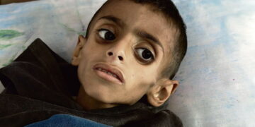 « Des enfants trop faibles pour pleurer »: Gaza entre les frappes et la faim