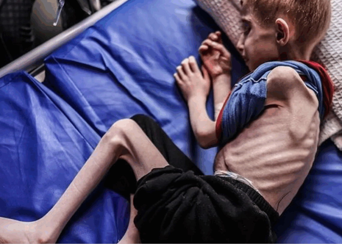 Trois bébés tués par une « faim sévère » en une semaine: La malnutrition atteint des niveaux alarmants à Gaza, les enfants les plus touchés