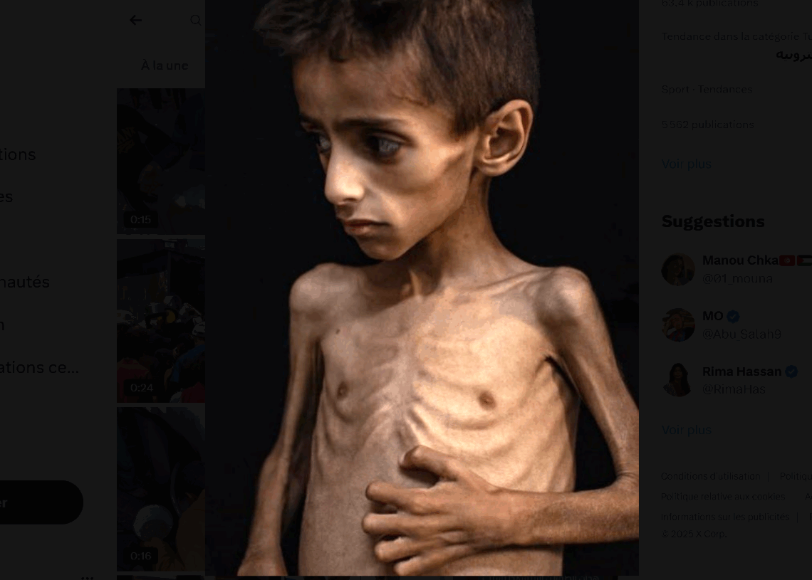 Gaza: 21 enfants sont morts de malnutrition en 72h