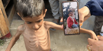 Gaza: 14 Palestiniens sont morts de faim au cours des 24h