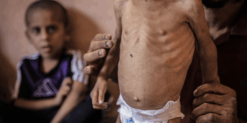 Le « pire scénario de famine est en cours dans la bande de Gaza », selon le rapport d’un organisme soutenu par l’ONU