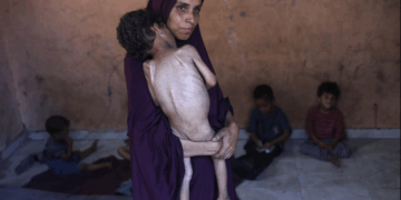 Gaza: Cinq Palestiniens sont morts de faim au cours des dernières 24 heures