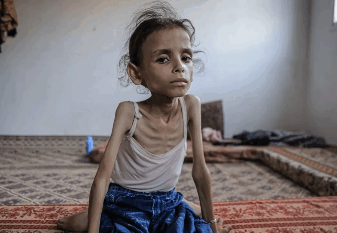 Le bilan s’alourdit à 175 morts : 6 Palestiniens sont morts de faim  au cours des dernières 24h