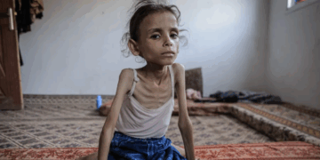 Le bilan s’alourdit à 175 morts : 6 Palestiniens sont morts de faim  au cours des dernières 24h