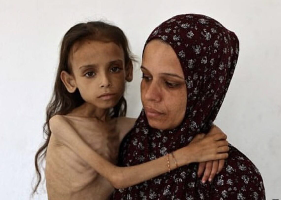 Gaza : cinq personnes supplémentaires sont mortes de faim et de malnutrition en 24 heures