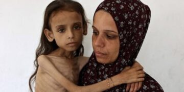 Gaza : cinq personnes supplémentaires sont mortes de faim et de malnutrition en 24 heures