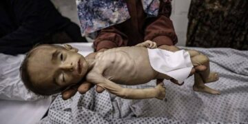 Gaza: 4  Palestiniens sont morts de faim au cours des dernières 24 heures