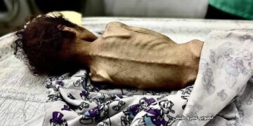 “Tout simplement catastrophique”: Handicap International tire la sonnette d’alarme sur la situation à Gaza