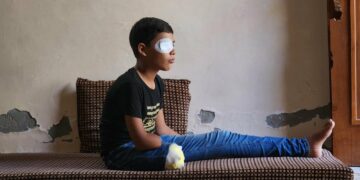 La guerre à Gaza a rendu au moins 21 000 enfants handicapés, selon un comité de l’ONU