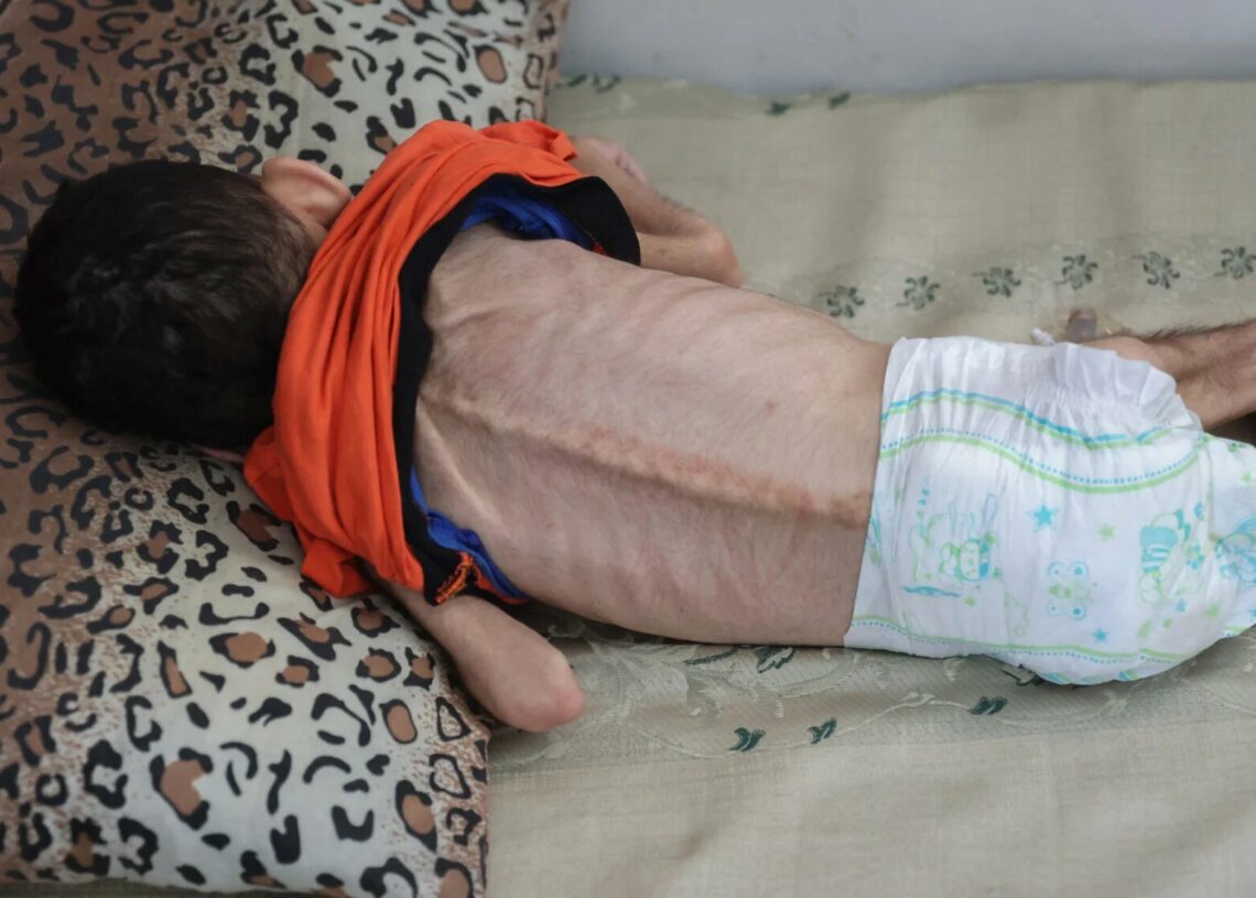 Gaza: La faim a tué quatre Palestiniens en 24 heures
