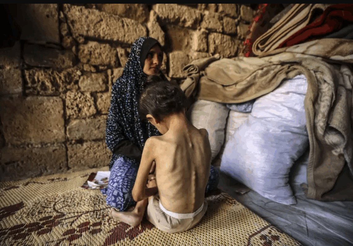 Un enfant sur cinq souffre de malnutrition dans la ville de Gaza, s’alarme l’Unicef