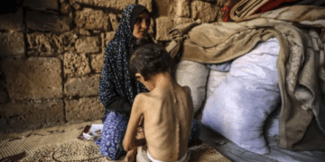 Un enfant sur cinq souffre de malnutrition dans la ville de Gaza, s’alarme l’Unicef