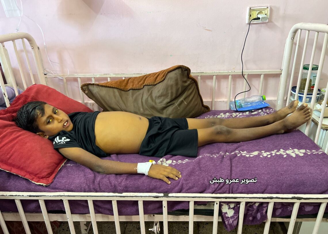 Gaza: La propagation des épidémies est “hors de contrôle”