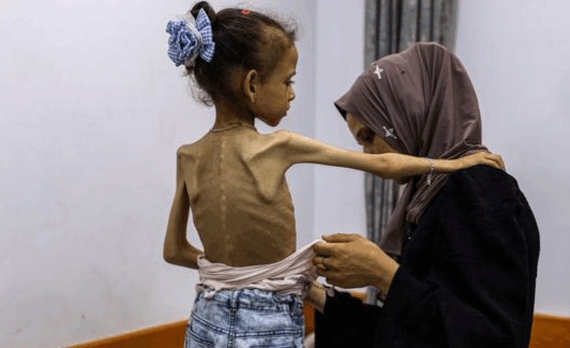 Hausse de 700%: Médecins du monde et Action contre la faim alertent sur l&rsquo;explosion de la malnutrition à Gaza